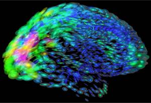 Foto: Arthur Toga, Laboratory of Neuro Imaging, Department of Neurology, UCLA School of Medicine